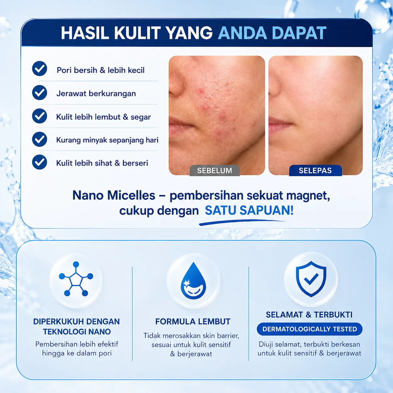 Cara Kecilkan Pori dan Hilangkan Jerawat Berkesan